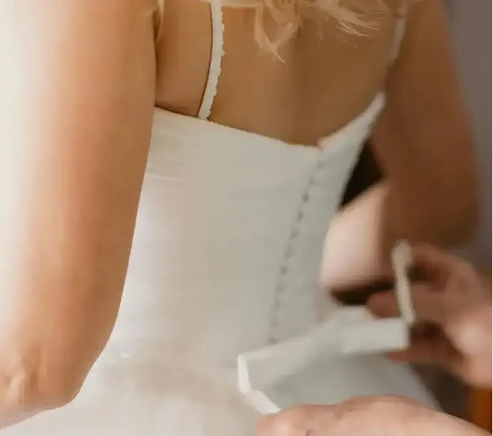 Alterations